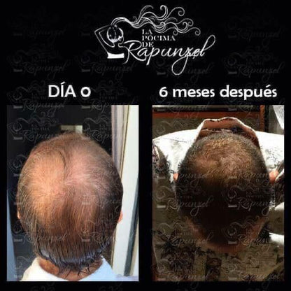 KIT SHAMPOO ANTI CAIDA CABALLERO