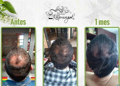 KIT SHAMPOO ANTI CAIDA CABALLERO